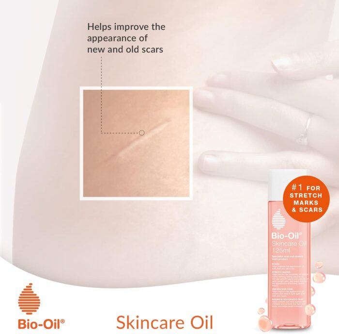 Bio-Oil Skincare Oil - Improve the Appearance of Scars, Stretch Marks and Skin Tone - 1 x 200 ml - Image 5